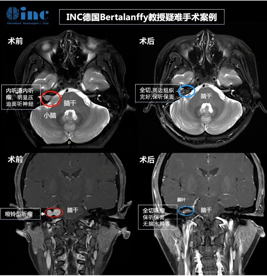 姜女士手术前后对比.jpg